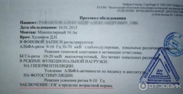 Срок действия ээг для водительской комиссии